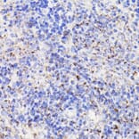 Immunohistochemistry - Anti-PDCD10/CCM3 Antibody (A92665) - Antibodies.com