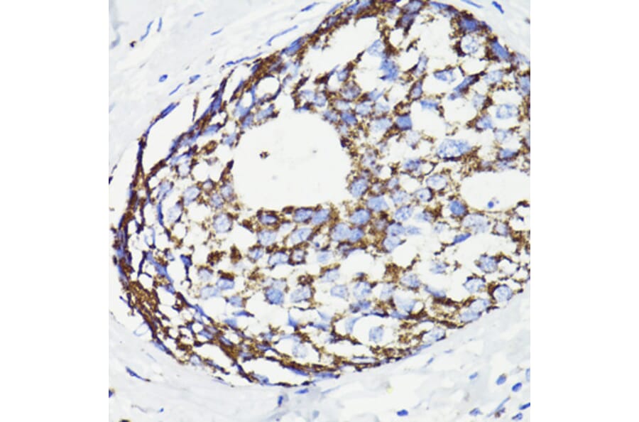 Immunohistochemistry - Anti-PDCD10/CCM3 Antibody (A92665) - Antibodies.com