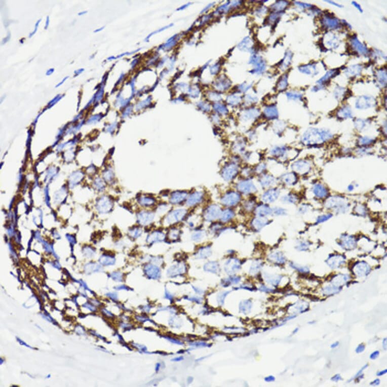 Immunohistochemistry - Anti-PDCD10/CCM3 Antibody (A92665) - Antibodies.com