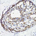 Immunohistochemistry - Anti-PDCD10/CCM3 Antibody (A92665) - Antibodies.com