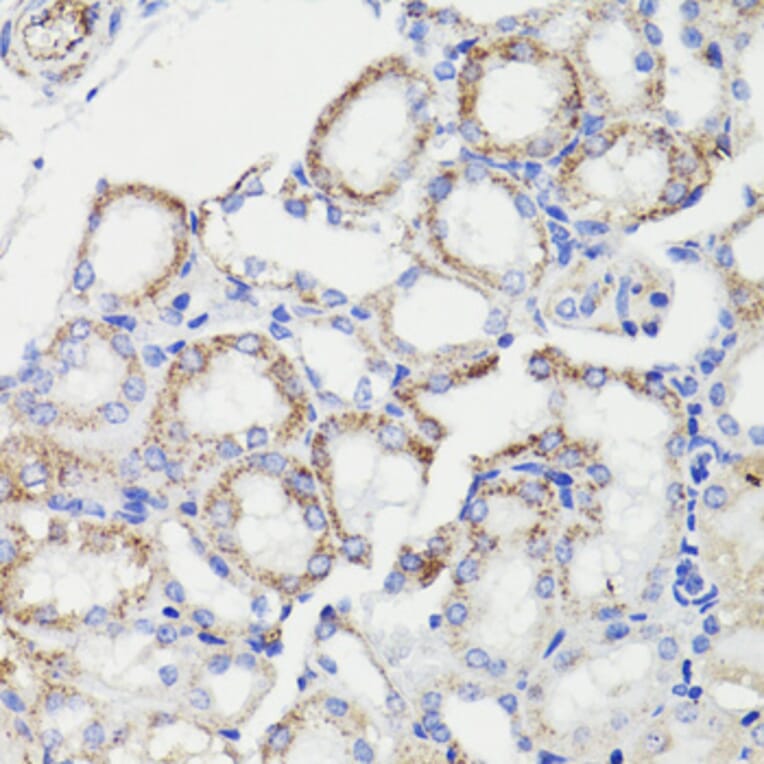 Immunohistochemistry - Anti-PDCD10/CCM3 Antibody (A92665) - Antibodies.com