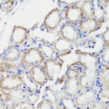 Immunohistochemistry - Anti-PDCD10/CCM3 Antibody (A92665) - Antibodies.com