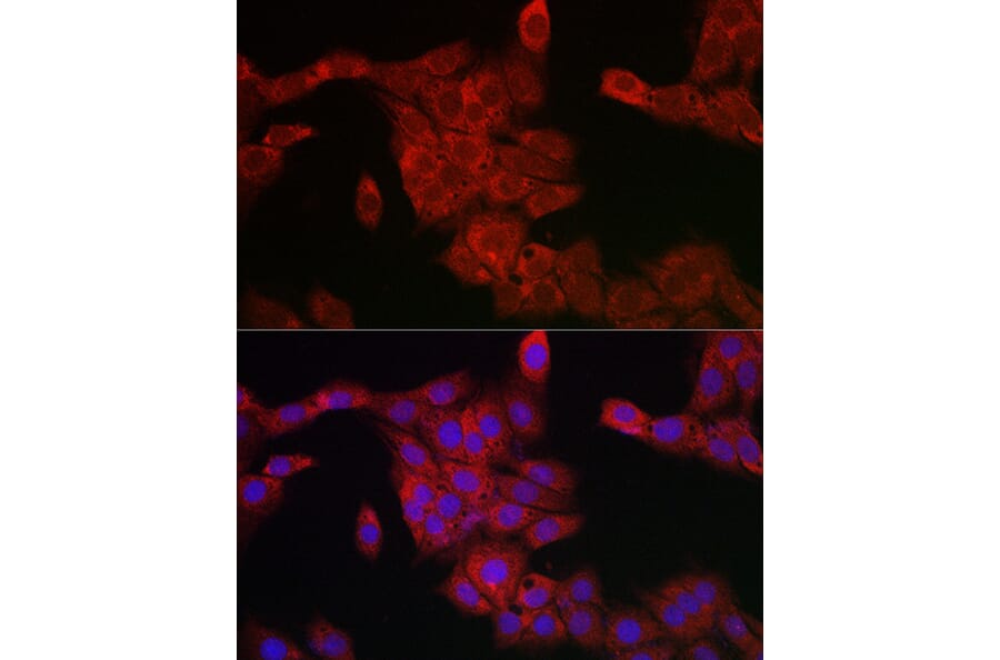 Immunofluorescence - Anti-PDCD10/CCM3 Antibody (A92665) - Antibodies.com