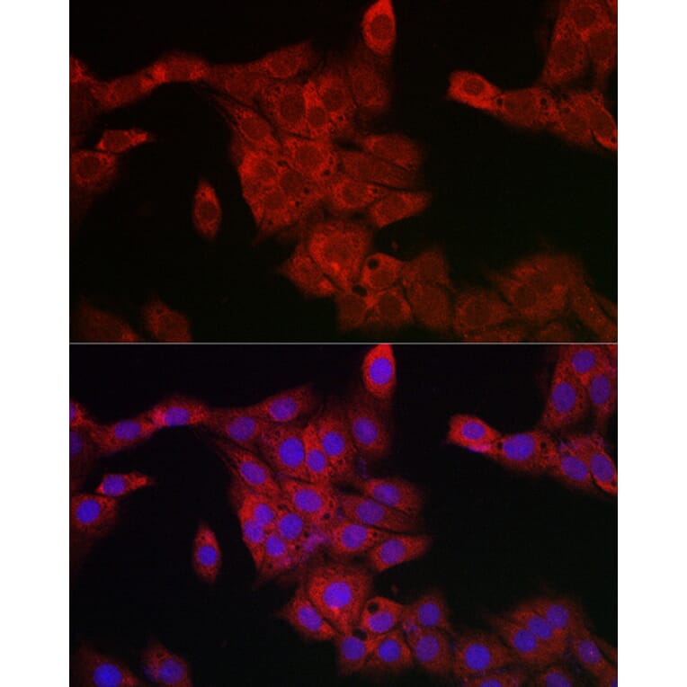 Immunofluorescence - Anti-PDCD10/CCM3 Antibody (A92665) - Antibodies.com
