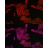 Immunofluorescence - Anti-PDCD10/CCM3 Antibody (A92665) - Antibodies.com