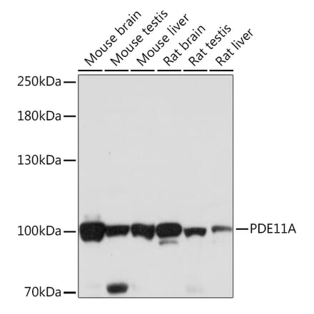 Western Blot - Anti-PDE11A Antibody (A92667) - Antibodies.com