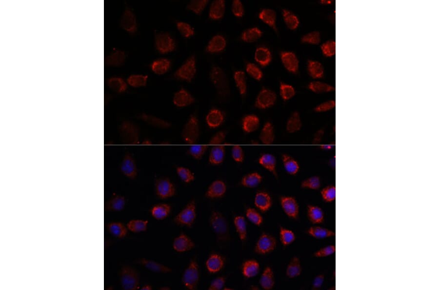 Immunofluorescence - Anti-PDE11A Antibody (A92667) - Antibodies.com