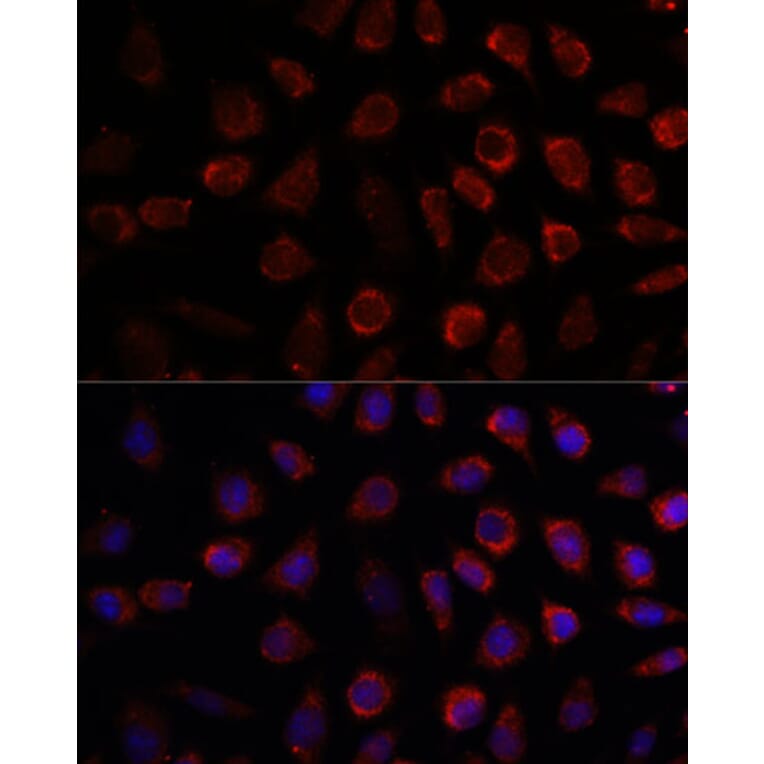 Immunofluorescence - Anti-PDE11A Antibody (A92667) - Antibodies.com