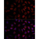 Immunofluorescence - Anti-PDE11A Antibody (A92667) - Antibodies.com