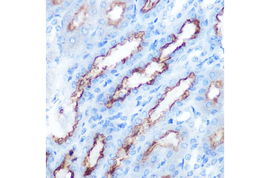 Immunohistochemistry - Anti-PDGF AA Antibody (A92668) - Antibodies.com