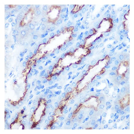 Immunohistochemistry - Anti-PDGF AA Antibody (A92668) - Antibodies.com