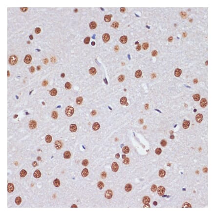 Immunohistochemistry - Anti-PELP1 Antibody (A92669) - Antibodies.com