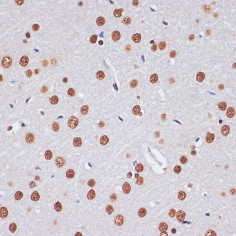 Immunohistochemistry - Anti-PELP1 Antibody (A92669) - Antibodies.com