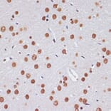 Immunohistochemistry - Anti-PELP1 Antibody (A92669) - Antibodies.com