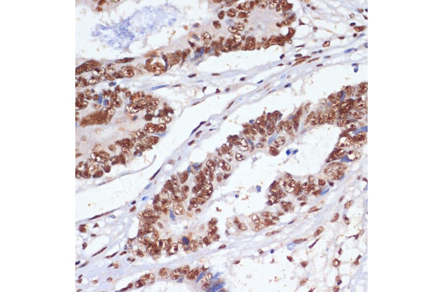 Immunohistochemistry - Anti-PELP1 Antibody (A92669) - Antibodies.com