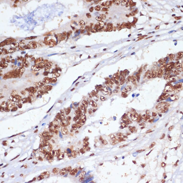 Immunohistochemistry - Anti-PELP1 Antibody (A92669) - Antibodies.com