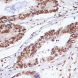 Immunohistochemistry - Anti-PELP1 Antibody (A92669) - Antibodies.com