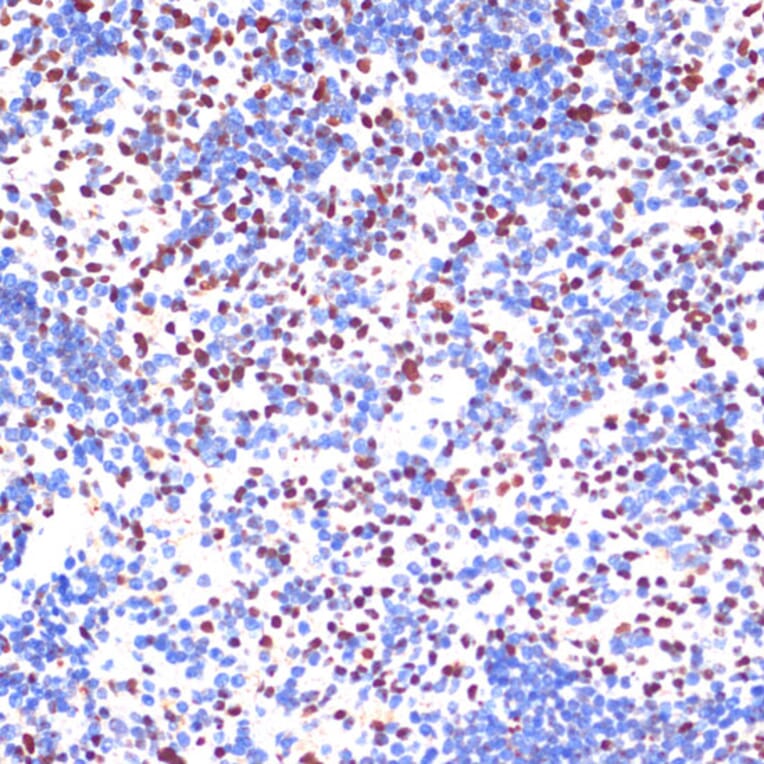 Immunohistochemistry - Anti-PELP1 Antibody (A92669) - Antibodies.com