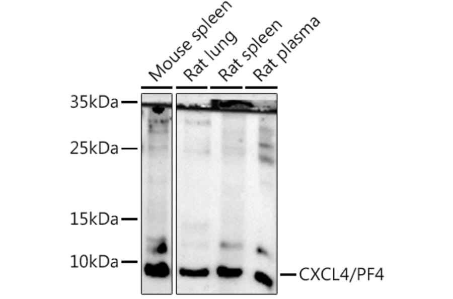 Western Blot - Anti-PF4 Antibody (A92672) - Antibodies.com