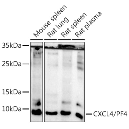 Western Blot - Anti-PF4 Antibody (A92672) - Antibodies.com