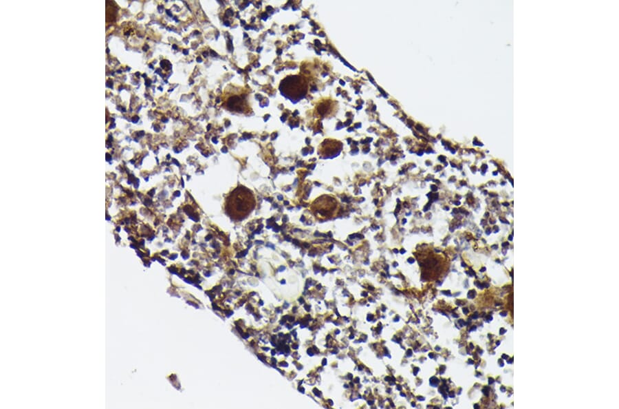 Immunohistochemistry - Anti-PF4 Antibody (A92672) - Antibodies.com