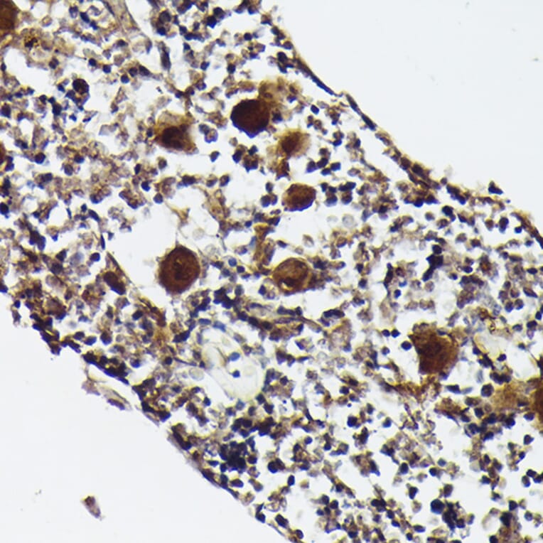 Immunohistochemistry - Anti-PF4 Antibody (A92672) - Antibodies.com