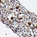 Immunohistochemistry - Anti-PF4 Antibody (A92672) - Antibodies.com