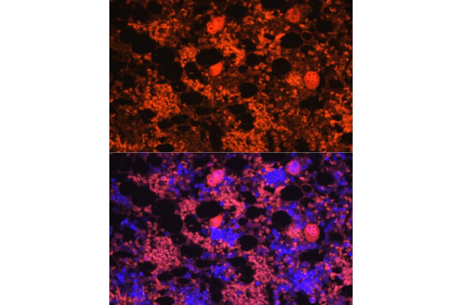 Immunofluorescence - Anti-PF4 Antibody (A92672) - Antibodies.com