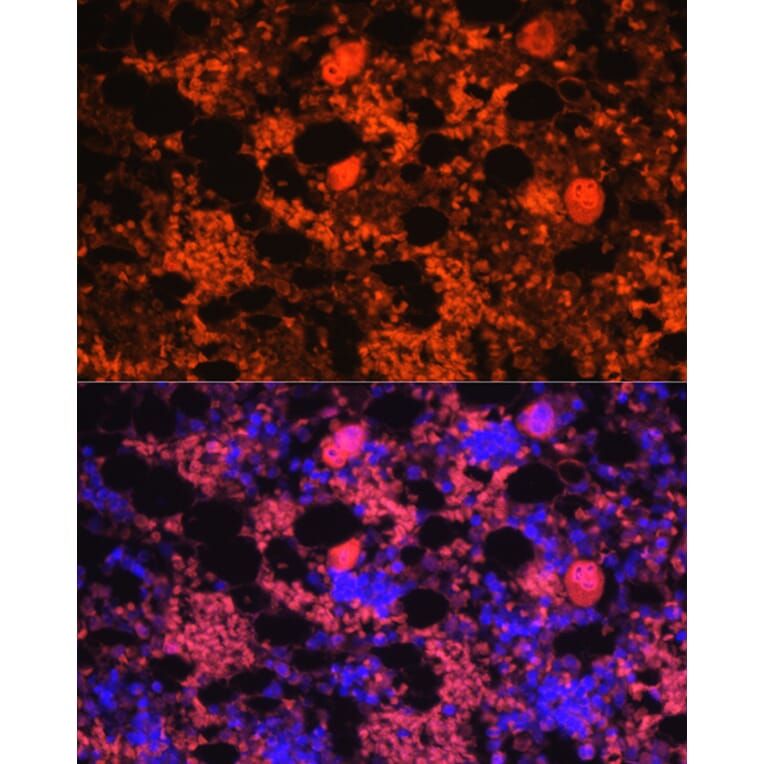 Immunofluorescence - Anti-PF4 Antibody (A92672) - Antibodies.com