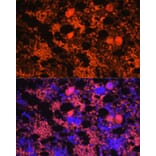 Immunofluorescence - Anti-PF4 Antibody (A92672) - Antibodies.com