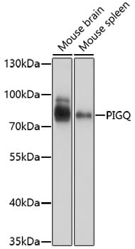Western blot analysis of extracts of various cell lines, using Anti-PIGQ Antibody (A17044) at 1:1,000 dilution.
Secondary antibody: Goat Anti-Rabbit IgG (H+L) (HRP) (AS014) at 1:10,000 dilution.
Lysates / proteins: 25µg per lane.
Blocking buffer: 3% non-fat dry milk in TBST.
Detection: ECL Basic Kit (RM00020).
Exposure time: 1s.