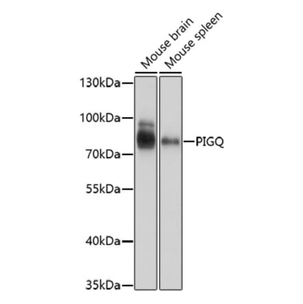 Western Blot - Anti-PIGQ Antibody (A92673) - Antibodies.com