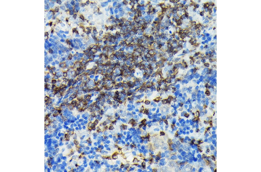 Immunohistochemistry - Anti-PI 3 Kinase catalytic subunit gamma/PI3K-gamma Antibody (A92674) - Antibodies.com