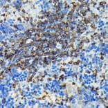 Immunohistochemistry - Anti-PI 3 Kinase catalytic subunit gamma/PI3K-gamma Antibody (A92674) - Antibodies.com
