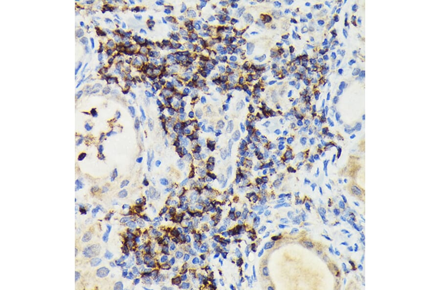 Immunohistochemistry - Anti-PI 3 Kinase catalytic subunit gamma/PI3K-gamma Antibody (A92674) - Antibodies.com