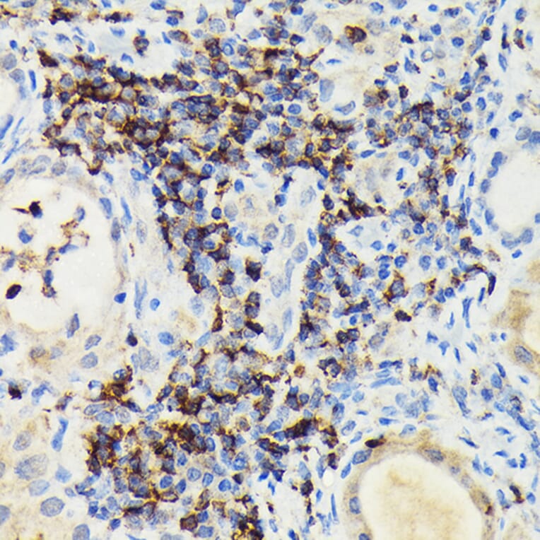 Immunohistochemistry - Anti-PI 3 Kinase catalytic subunit gamma/PI3K-gamma Antibody (A92674) - Antibodies.com