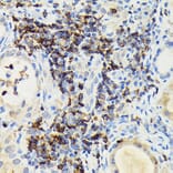 Immunohistochemistry - Anti-PI 3 Kinase catalytic subunit gamma/PI3K-gamma Antibody (A92674) - Antibodies.com