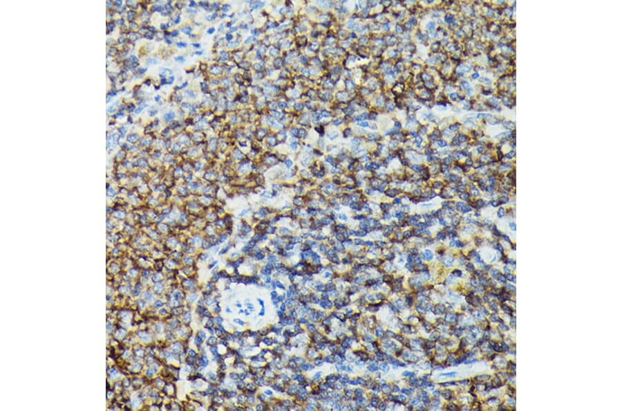 Immunohistochemistry - Anti-PI 3 Kinase catalytic subunit gamma/PI3K-gamma Antibody (A92674) - Antibodies.com