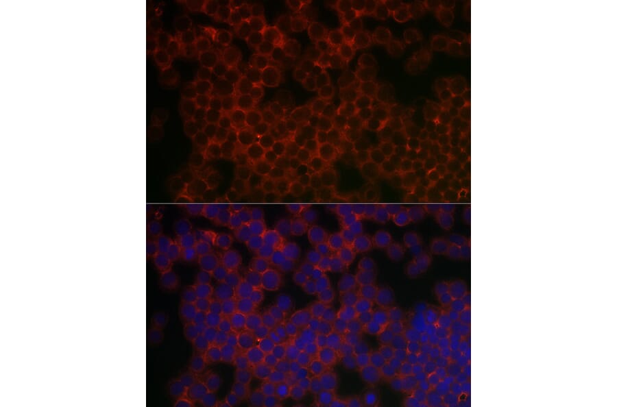 Immunofluorescence - Anti-PI 3 Kinase catalytic subunit gamma/PI3K-gamma Antibody (A92674) - Antibodies.com