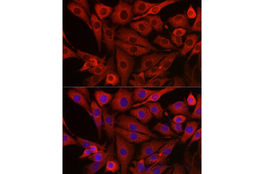Immunofluorescence - Anti-PI 3 Kinase catalytic subunit gamma/PI3K-gamma Antibody (A92674) - Antibodies.com