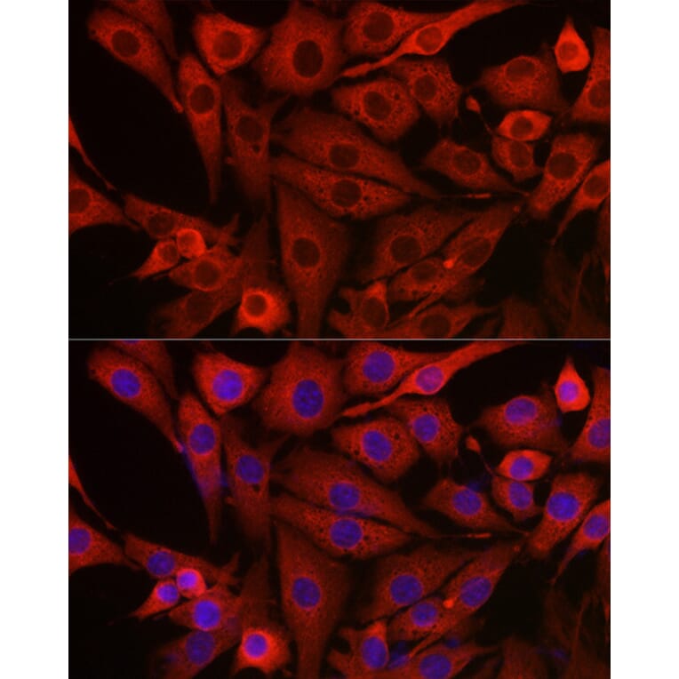 Immunofluorescence - Anti-PI 3 Kinase catalytic subunit gamma/PI3K-gamma Antibody (A92674) - Antibodies.com