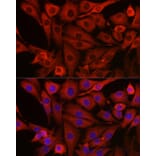 Immunofluorescence - Anti-PI 3 Kinase catalytic subunit gamma/PI3K-gamma Antibody (A92674) - Antibodies.com