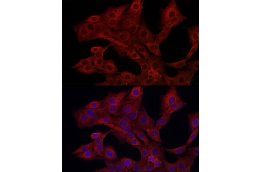Immunofluorescence - Anti-PI 3 Kinase catalytic subunit gamma/PI3K-gamma Antibody (A92674) - Antibodies.com