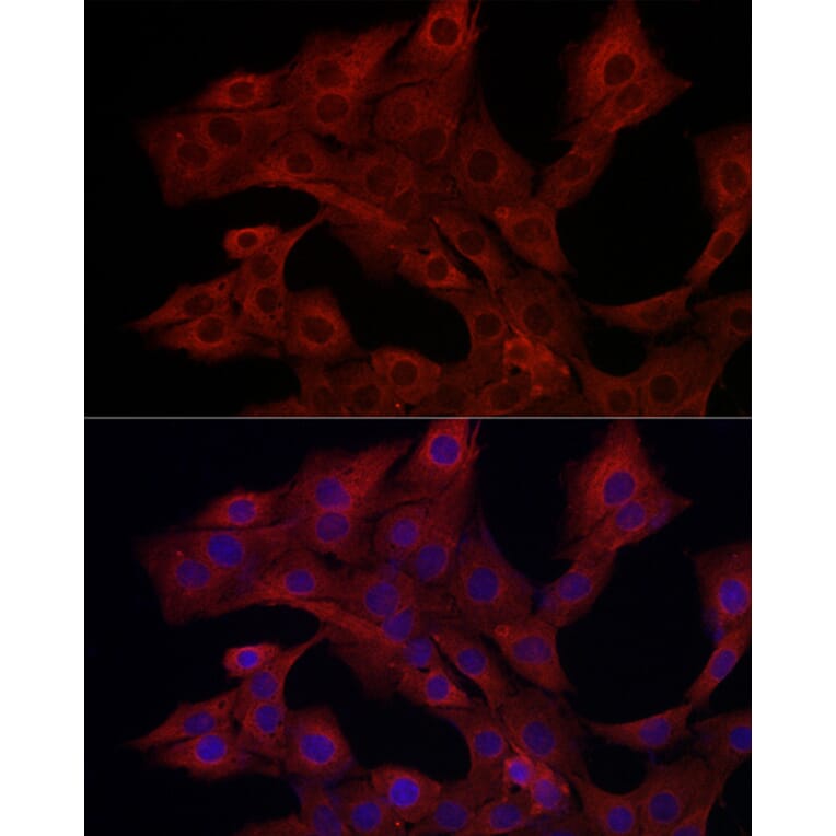 Immunofluorescence - Anti-PI 3 Kinase catalytic subunit gamma/PI3K-gamma Antibody (A92674) - Antibodies.com
