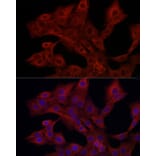 Immunofluorescence - Anti-PI 3 Kinase catalytic subunit gamma/PI3K-gamma Antibody (A92674) - Antibodies.com