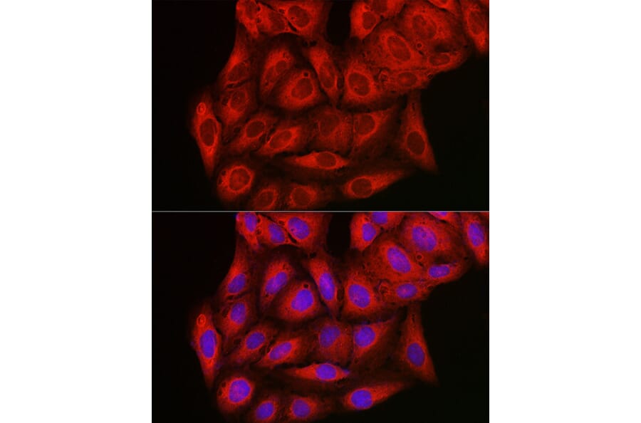 Immunofluorescence - Anti-PI 3 Kinase catalytic subunit gamma/PI3K-gamma Antibody (A92674) - Antibodies.com