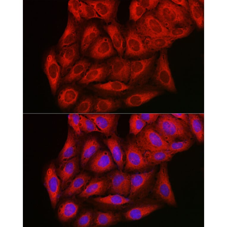 Immunofluorescence - Anti-PI 3 Kinase catalytic subunit gamma/PI3K-gamma Antibody (A92674) - Antibodies.com
