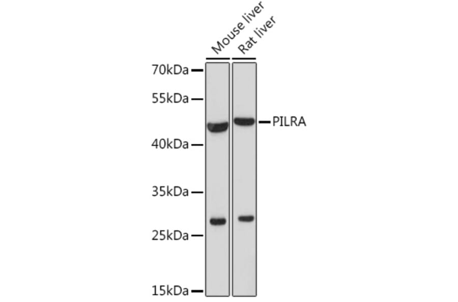 Western Blot - Anti-PILRA Antibody (A92675) - Antibodies.com