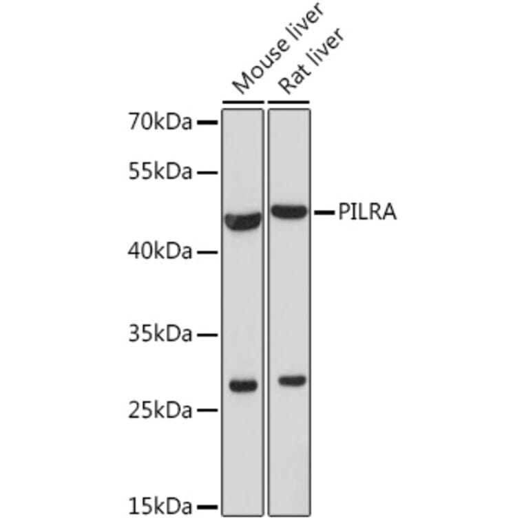 Western Blot - Anti-PILRA Antibody (A92675) - Antibodies.com