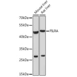 Western Blot - Anti-PILRA Antibody (A92675) - Antibodies.com